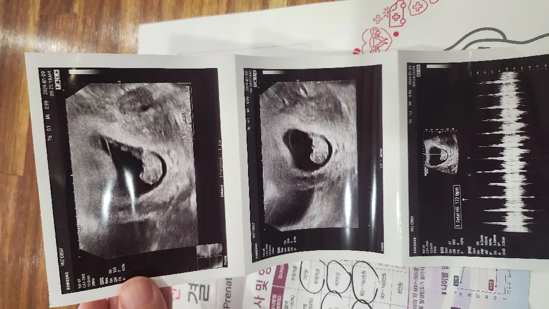 8주6일차 애기 만나고왔어요~