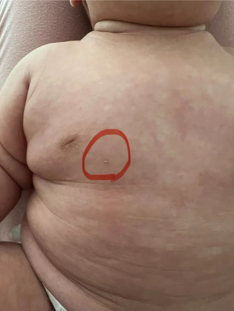 아기 가슴부분에 이게 뭘까요