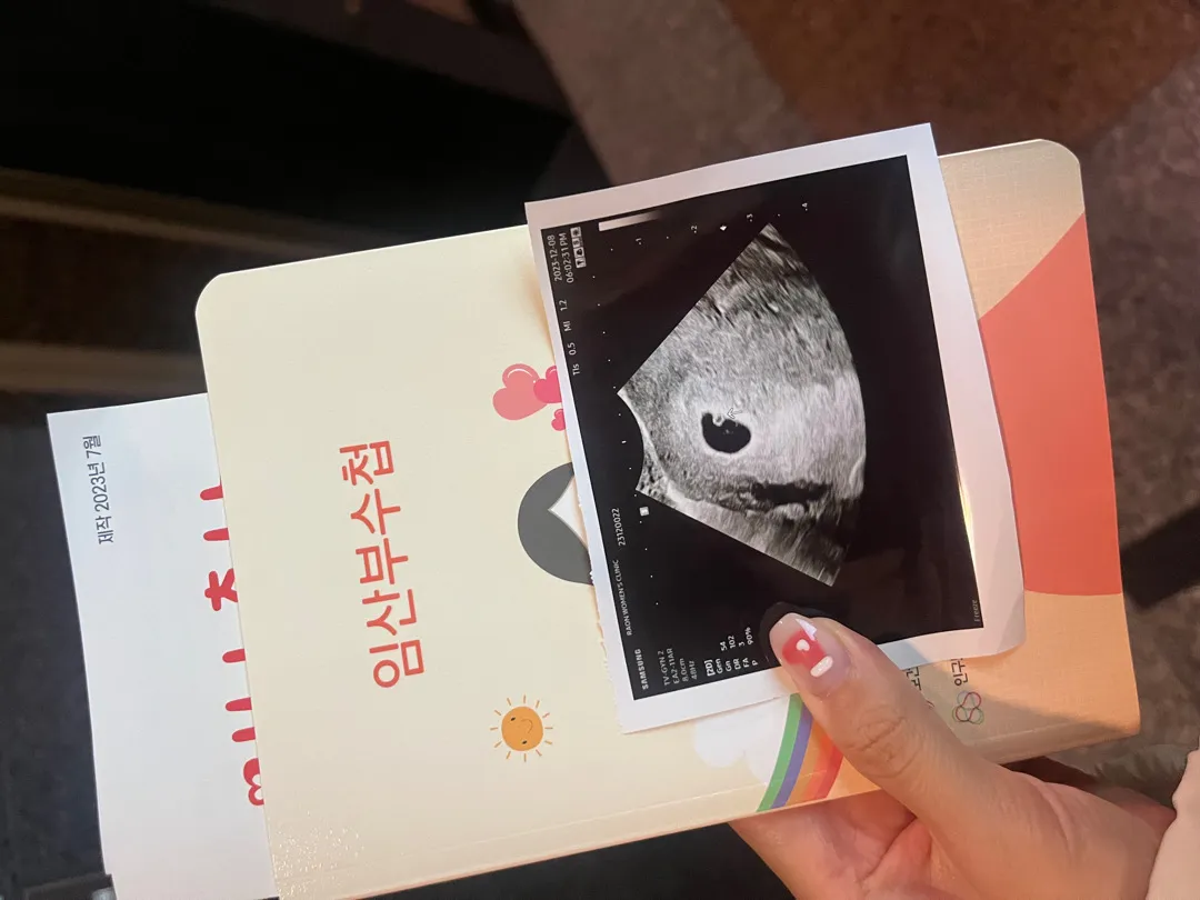 5주 1일 초음파 보고 왔어요! 