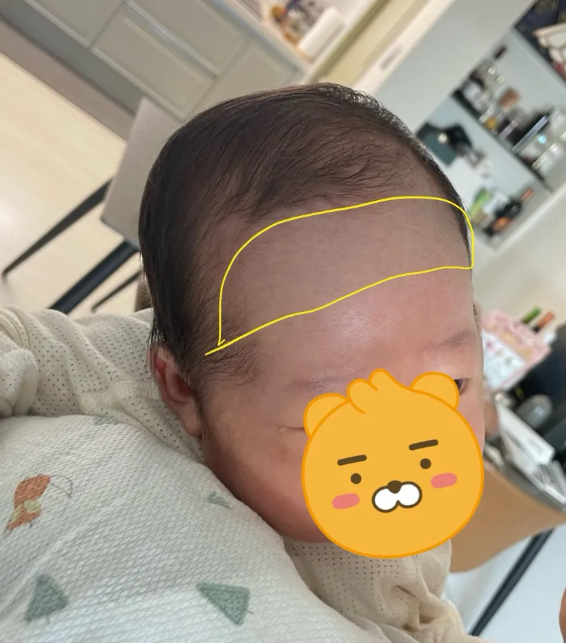 아기이마가 파랗게 보이시는분 있나요?