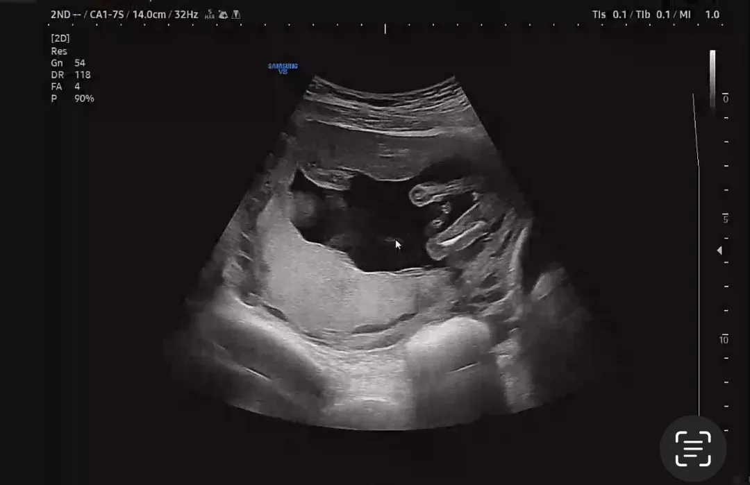 오늘 딸 맘 확정받았어요!