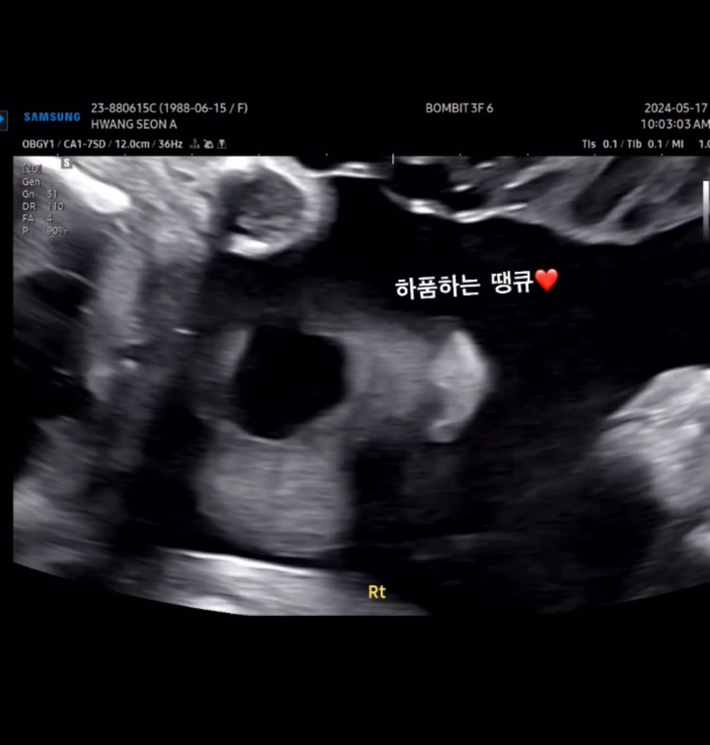 하품하는 울 애기 자랑 봐쥬세용
