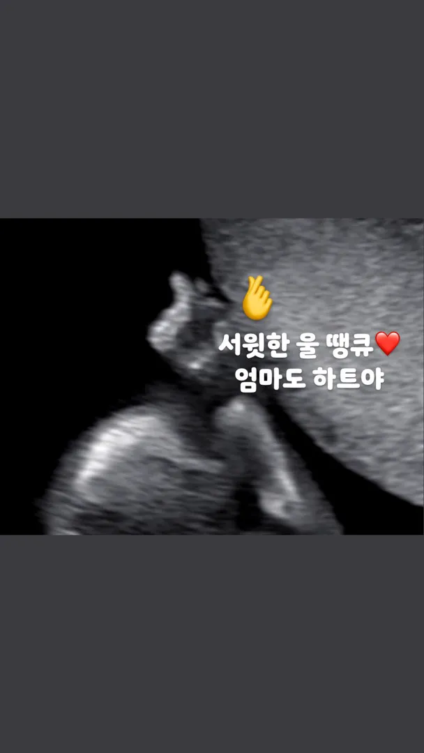 16주5일 아들둥이 확정🌶️🌶️
