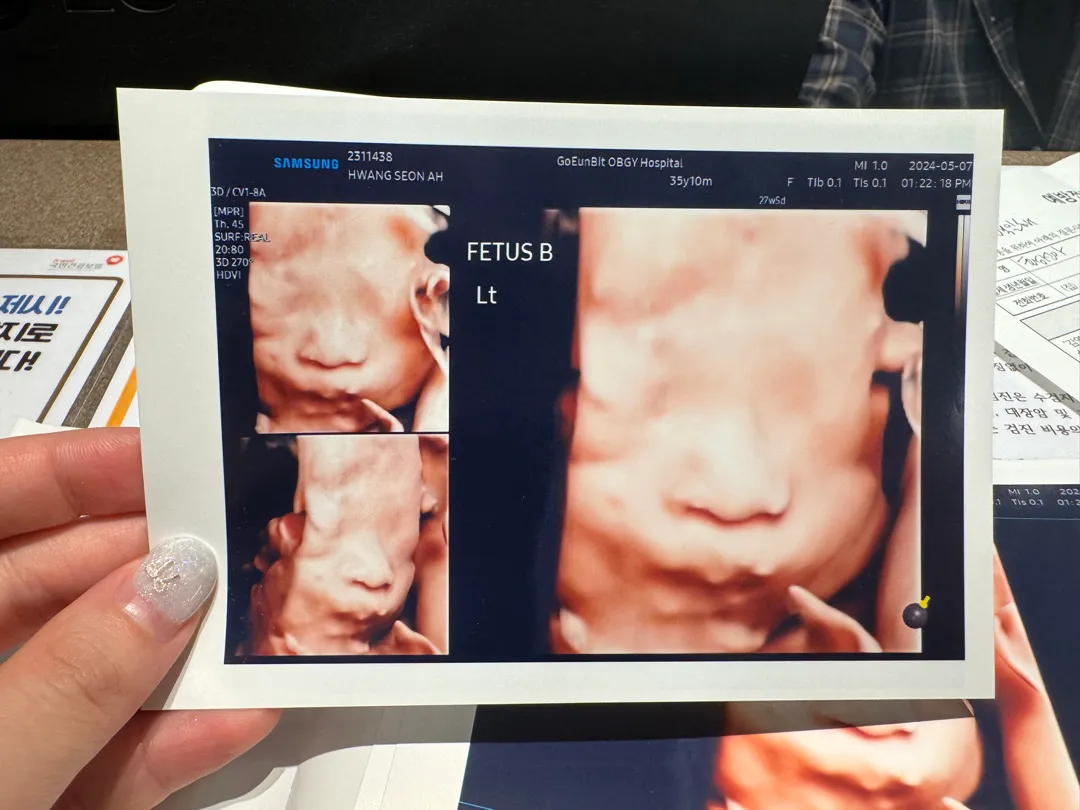 둥이 입체촘파 보구왔어요😄
