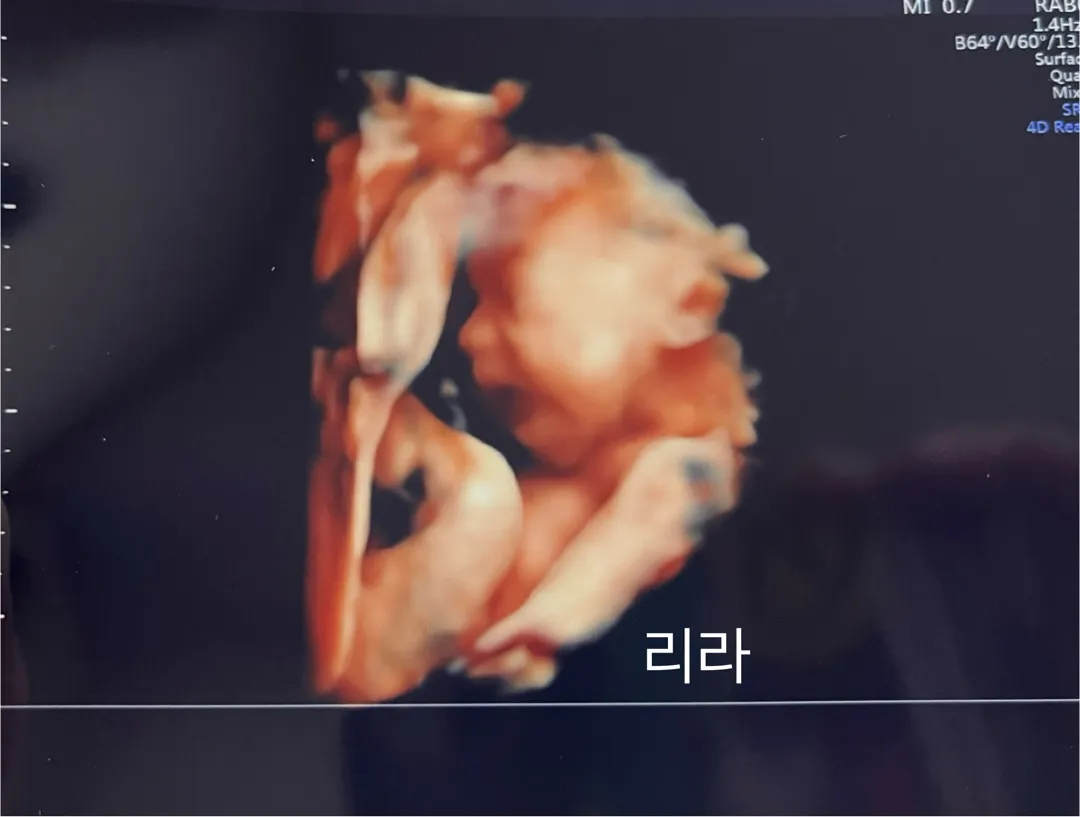 정기검진 갔다가 찍혔어요 ㅋㅋㅋ