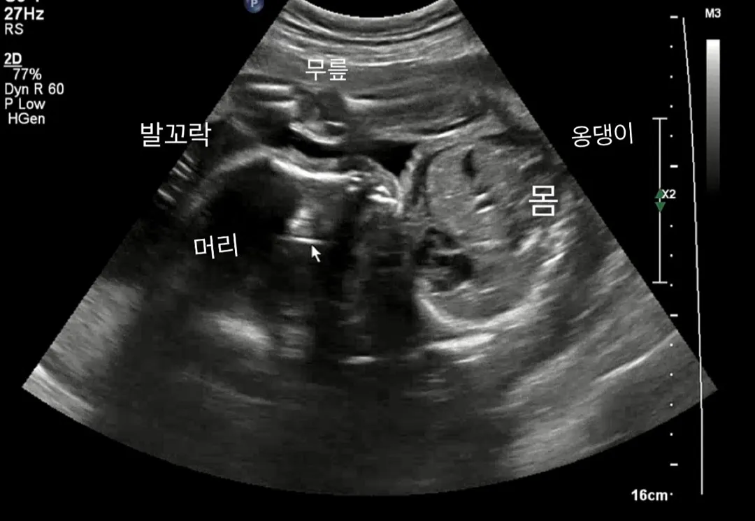 이런 아기도 있나요?ㅋ