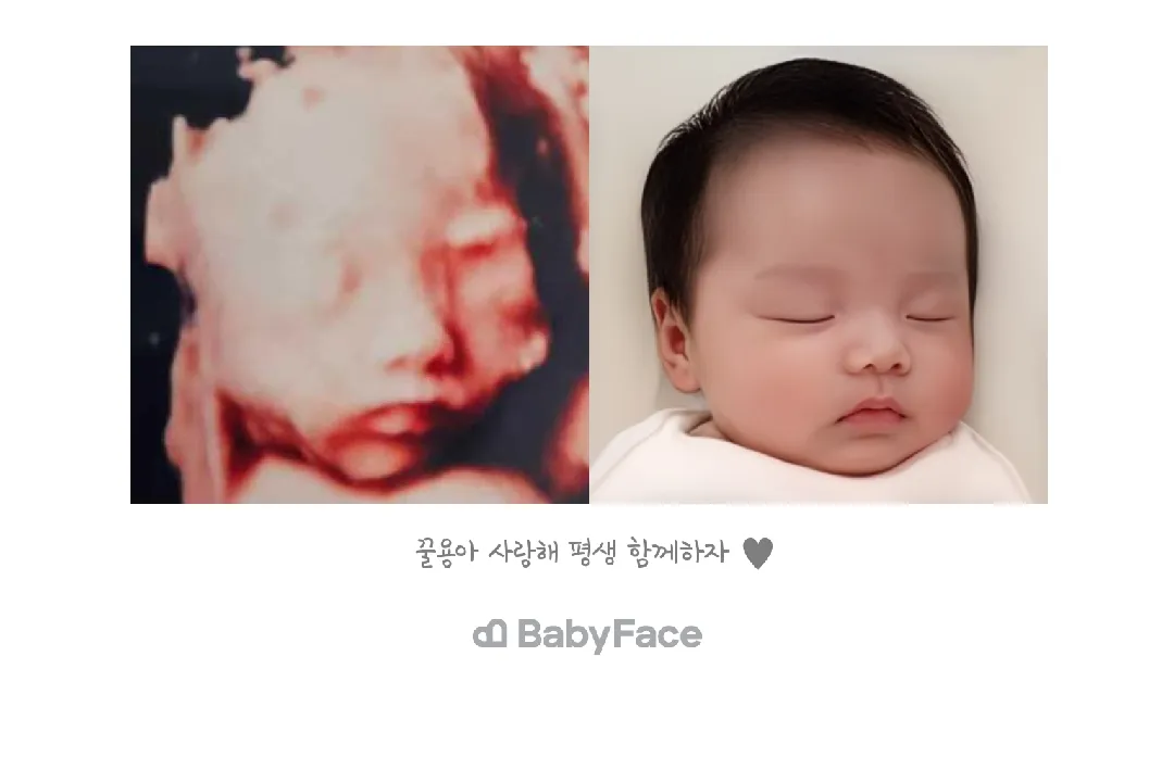 베이비페이스 했어용