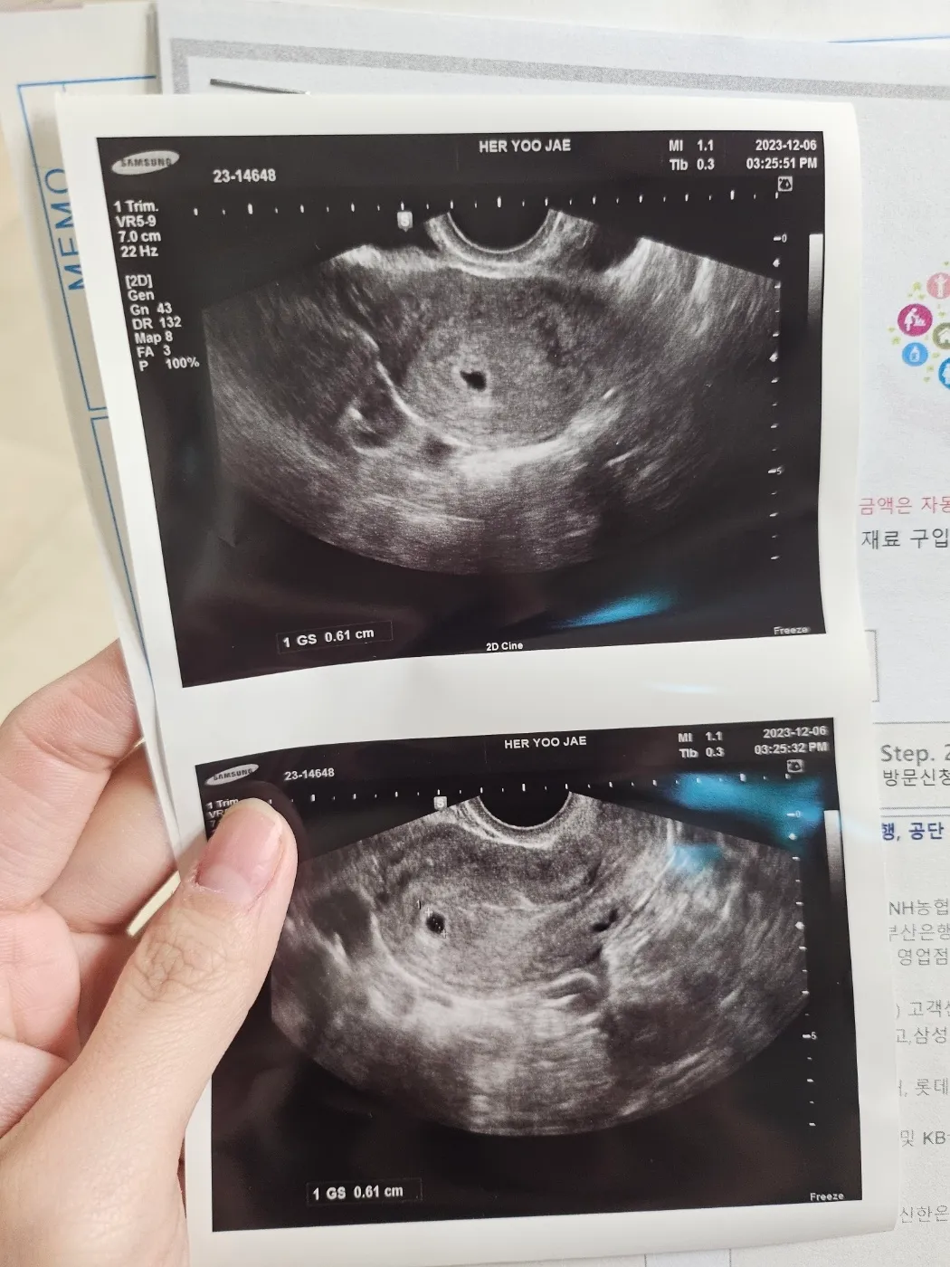 너무 불안하네요 ㅠㅠ