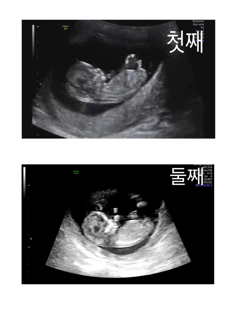 저두 각도법 봐즈세요🤔🤔