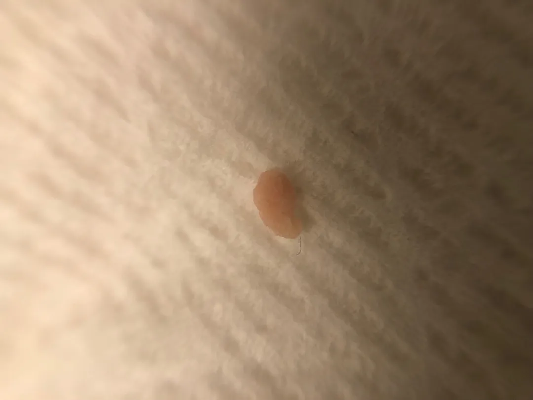 좁쌀크기 이게 뭘까요? (사진 주의)