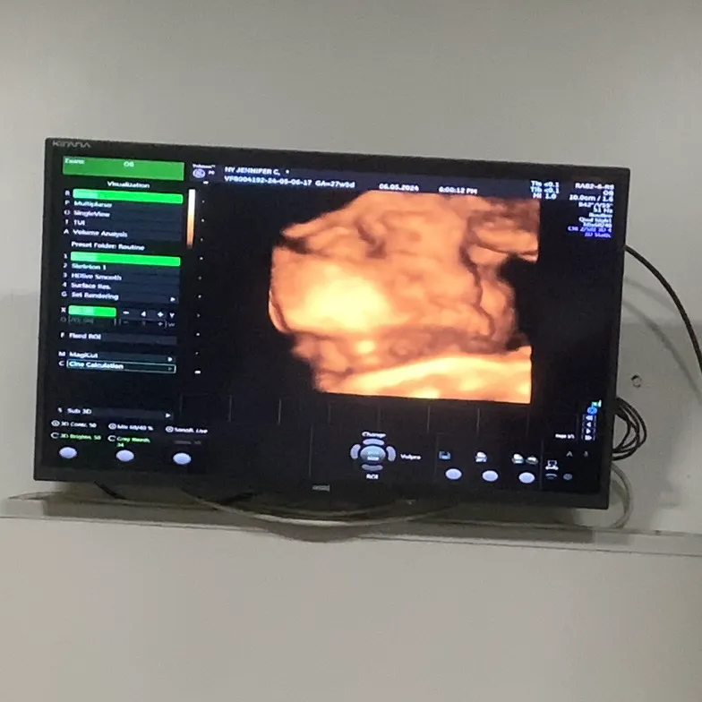 usg adek usia 27minggu