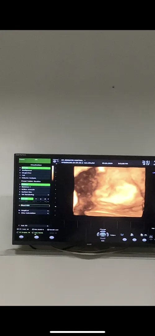 baby num 2