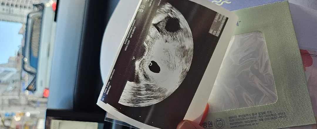 몇일전 다이아반지 보고왔어요
