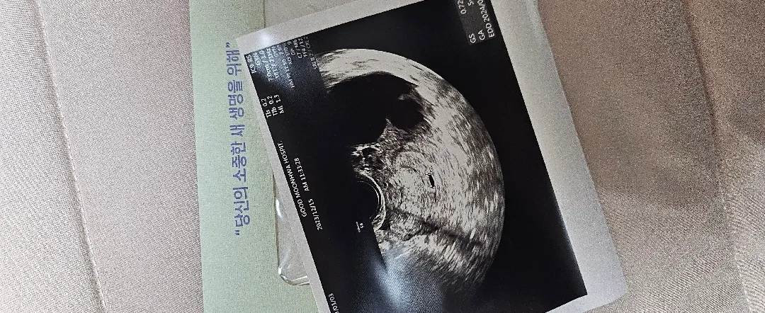 병원 첫번째 방문해서 아기집 보고왔어요!