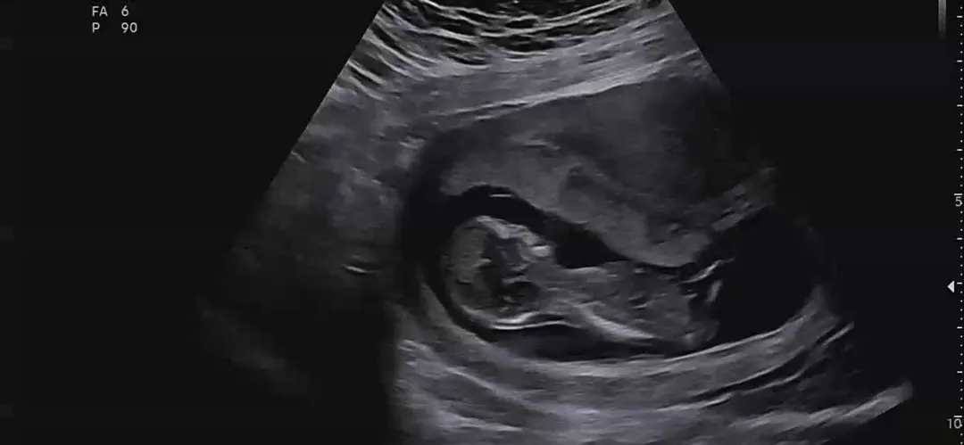 마구마구 댓글 달아주세요❣️👶🏻🩷