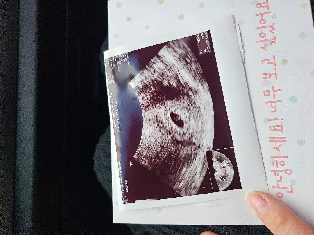 오늘 아기집보고 왔어요~^^