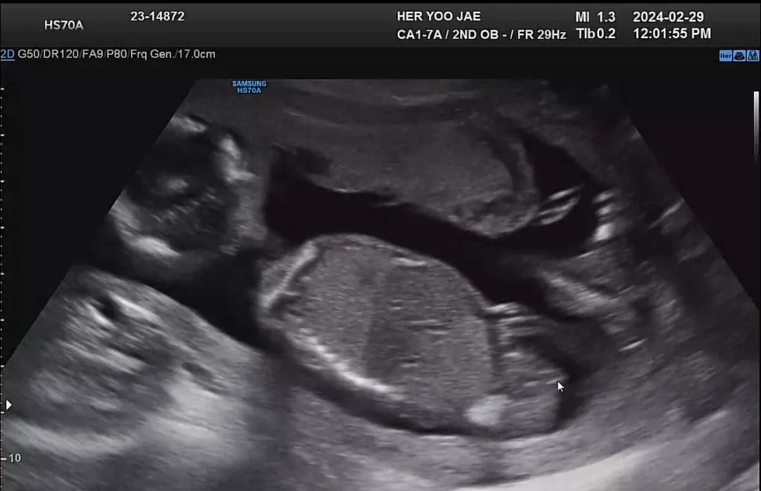 예삐딸맘이라고 합니당❤️(16w4d)