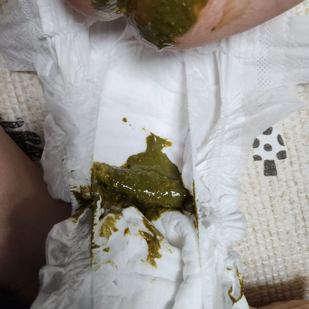57일 아기변 