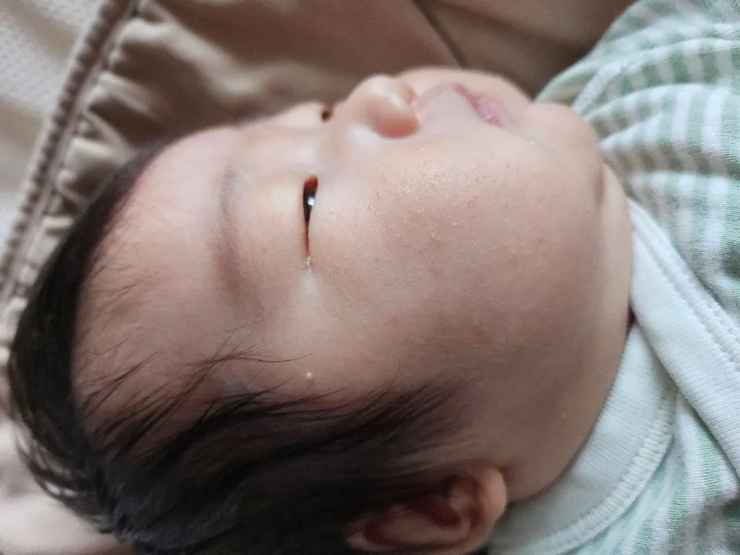 태열인가요? 봐주세요~