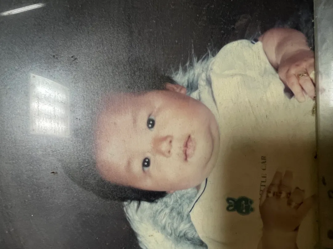 아기머리 3주차이😭