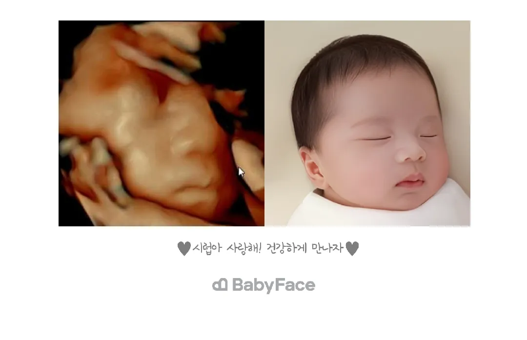베이비페이스 했어요 😆