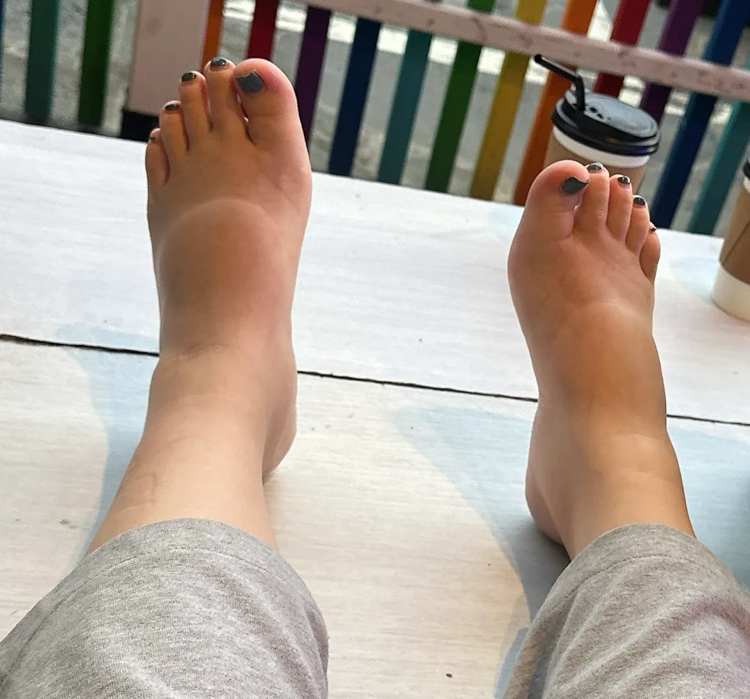 부종 붓기