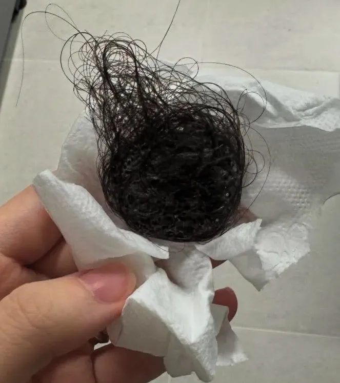 산후탈모 시간지나니 극복