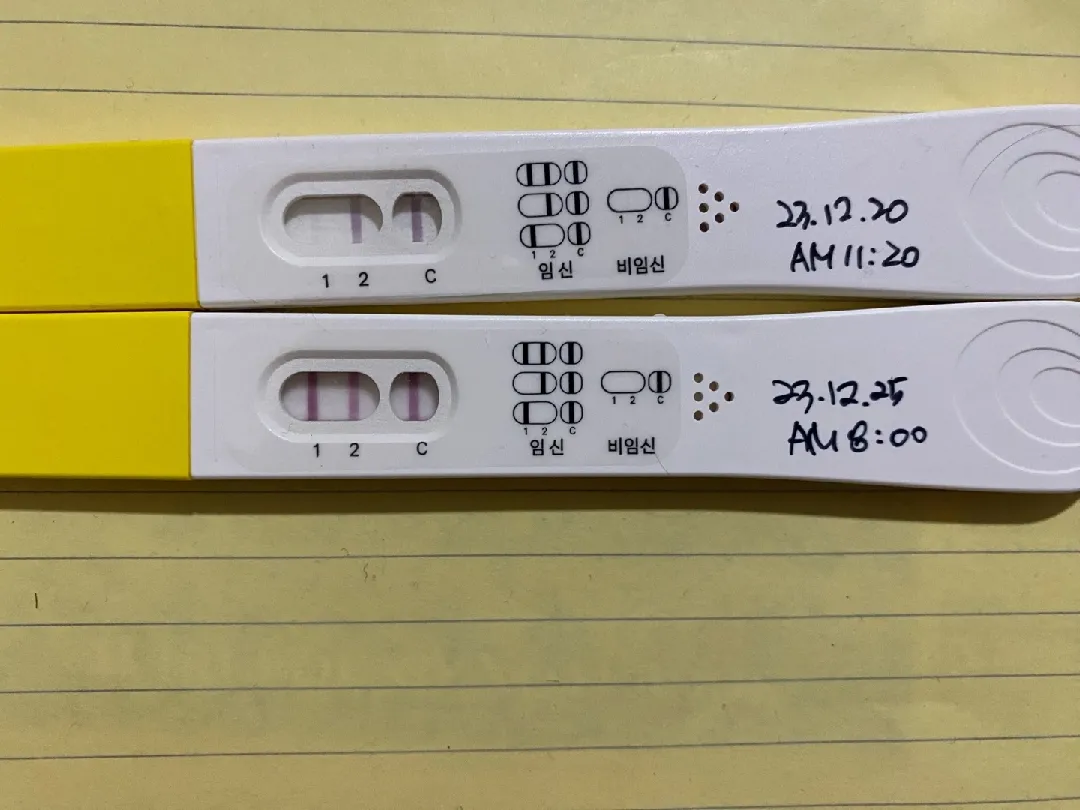 5주2일차 예상인데 언제 병원 가야 하나요?