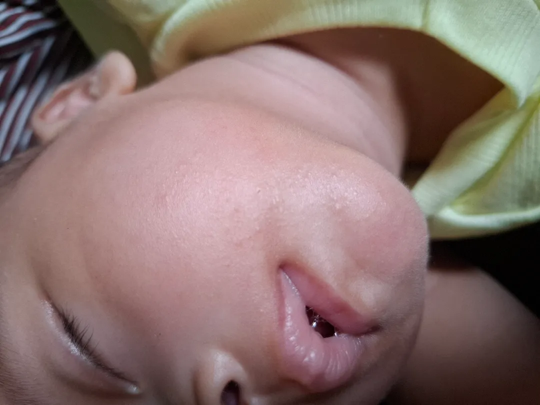 Kulit bayi bintik2