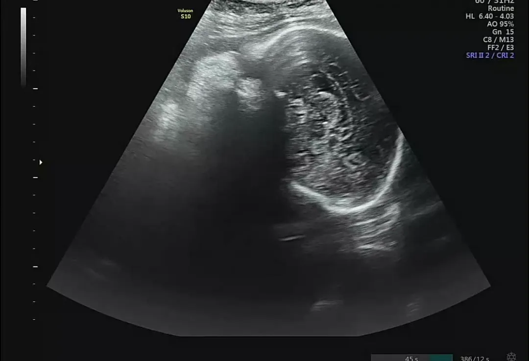 아가 뒷통수가 원래 이런가요..?