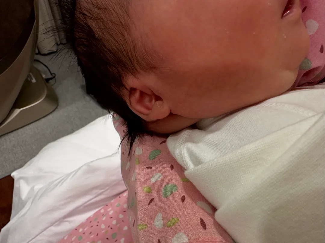 출산 후 아기 목뒤가 두껍다고 대학병원 진료 의뢰받았어요...