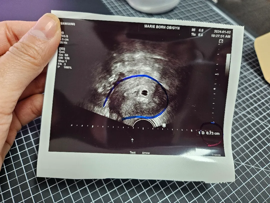 4주 5일 아기집보고 왔어요 *^^*