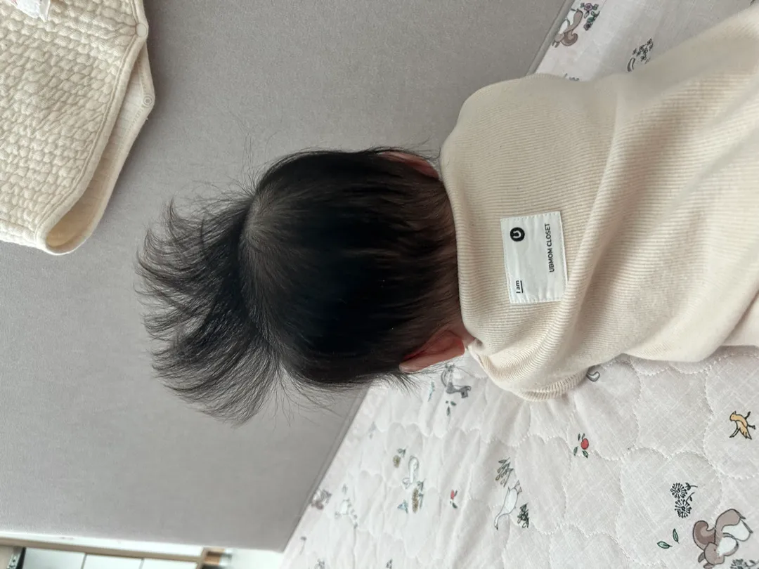 뒤통수 땜빵