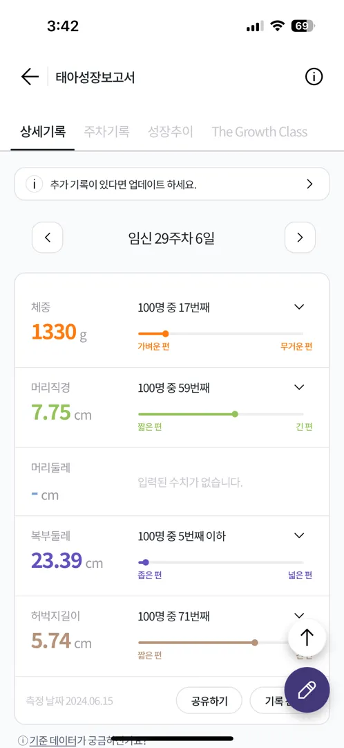 아기 머리크기