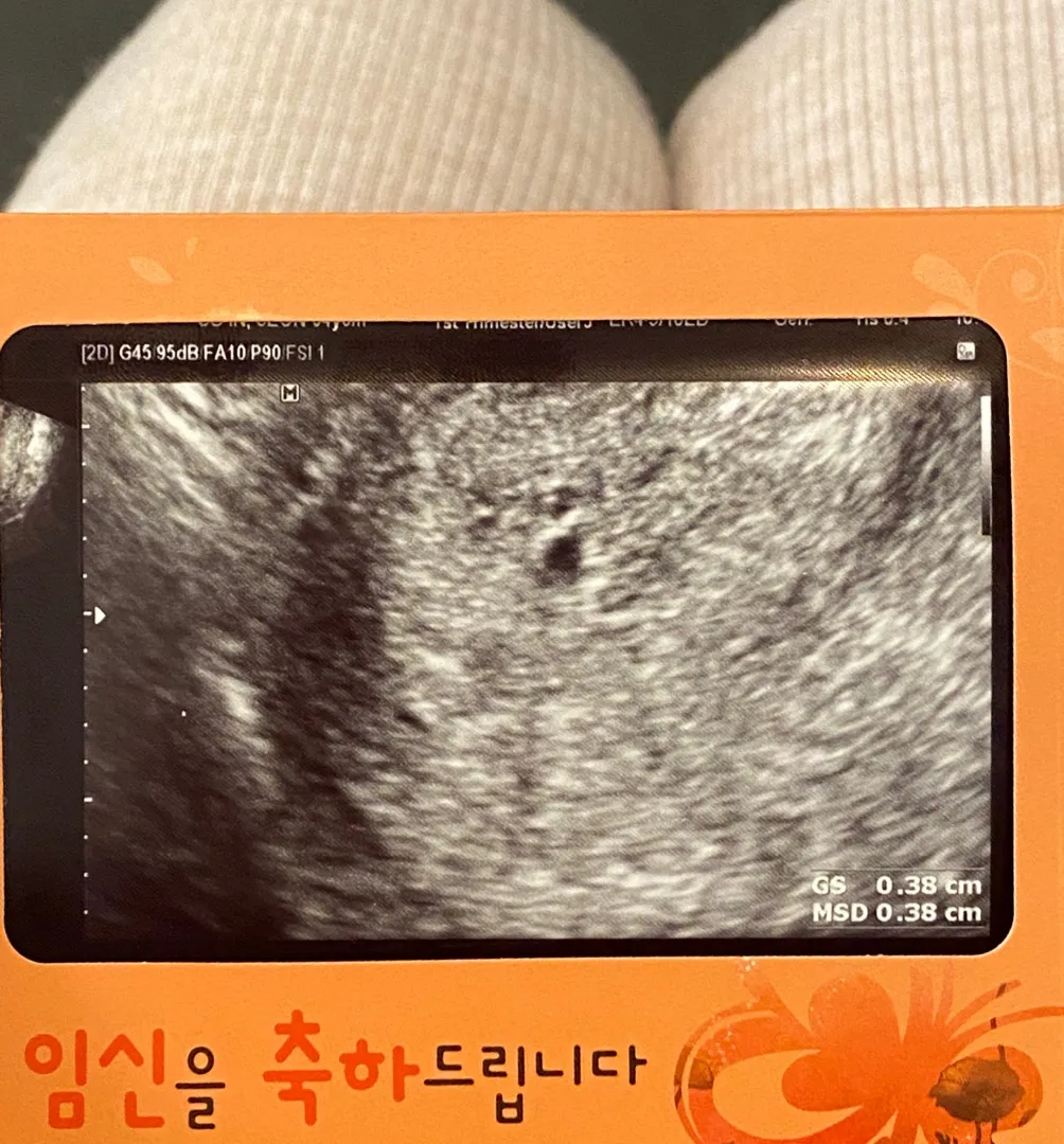 두둥❤️ 저도 오늘 초음파 보고왔어요!!