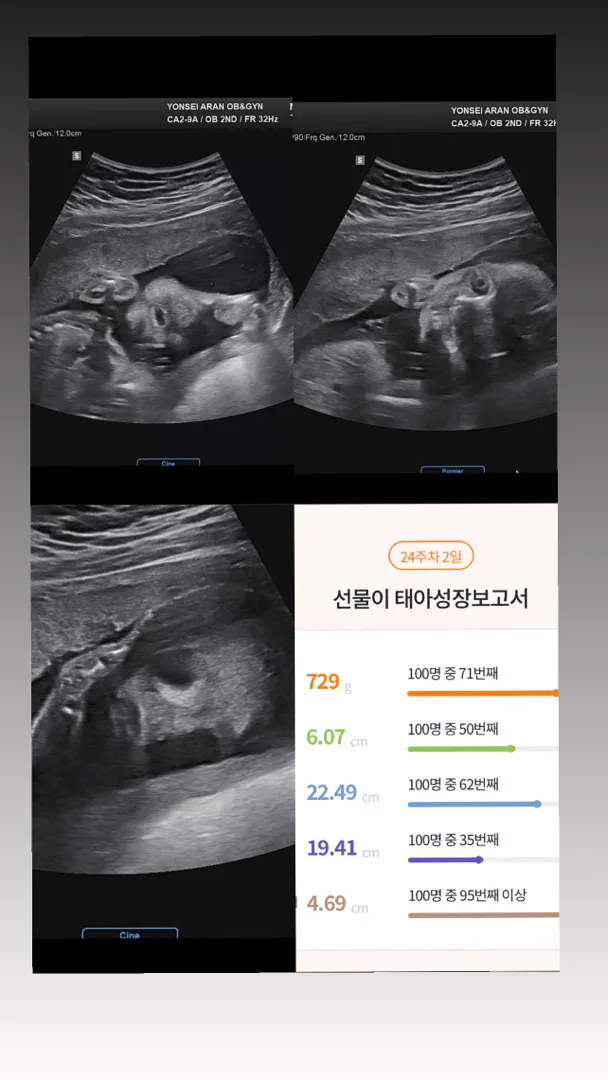 (24주2일) D-96 ,임신 후 +1.5kg