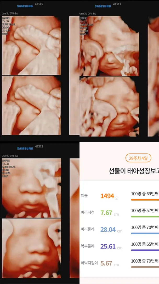 (29주4일) 입체초음파 재검하고왔어요!!!!!