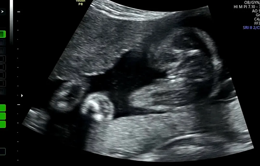 더 이상의 성별 반전은 없겠죠?