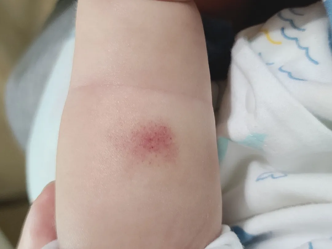 자기 팔 빠는 아기..?