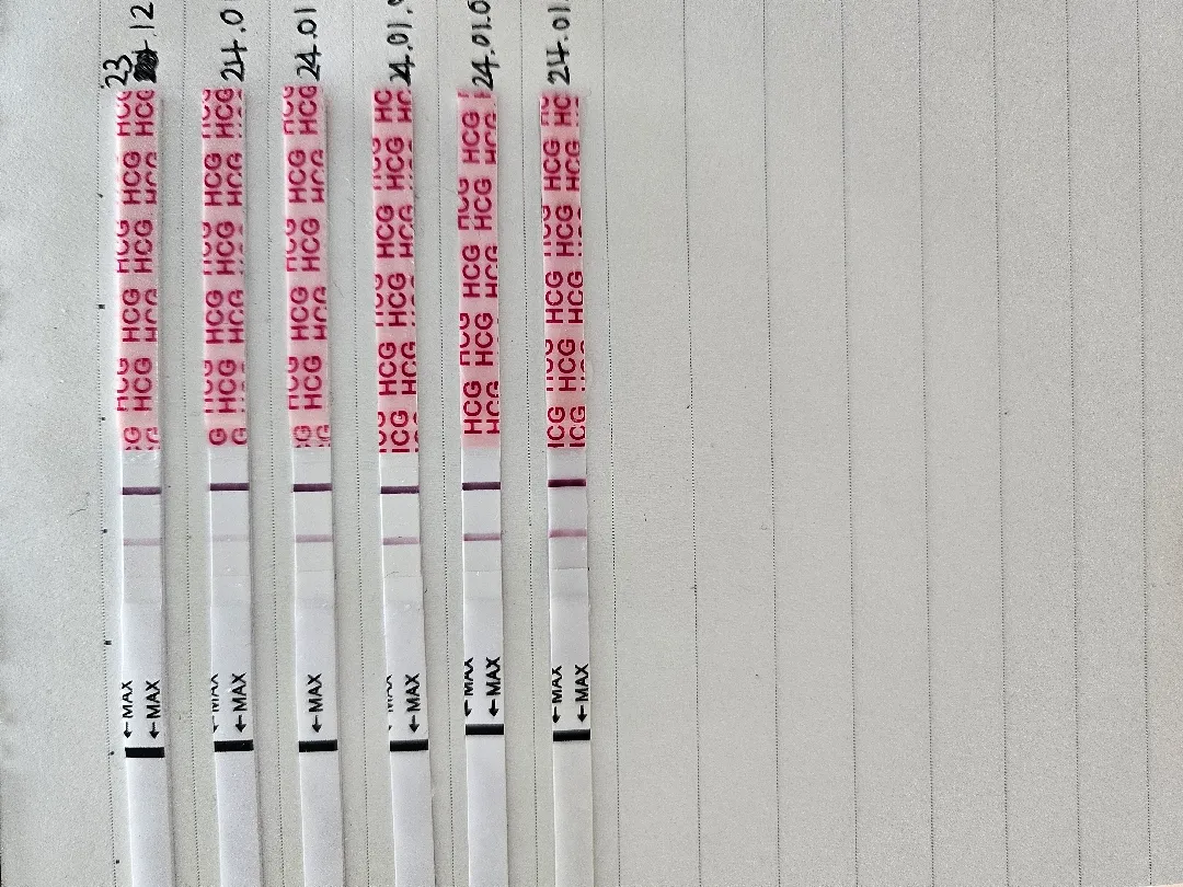 금요일에 병원 예약했는뎅....