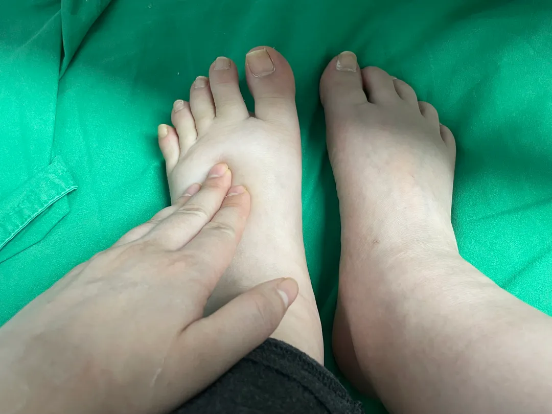 제왕절개 산후부종