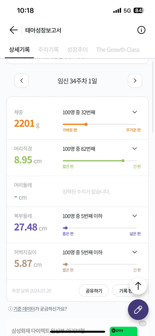 아기 크기 걱정되네요..