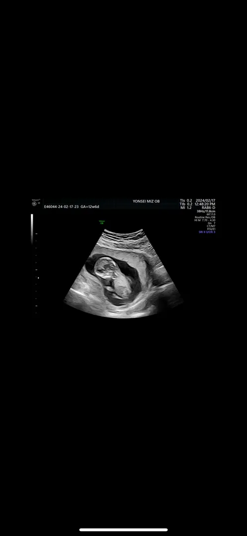 12주 6일) 각도법 고수님들의 도움이 필요합니다ㅠㅠ