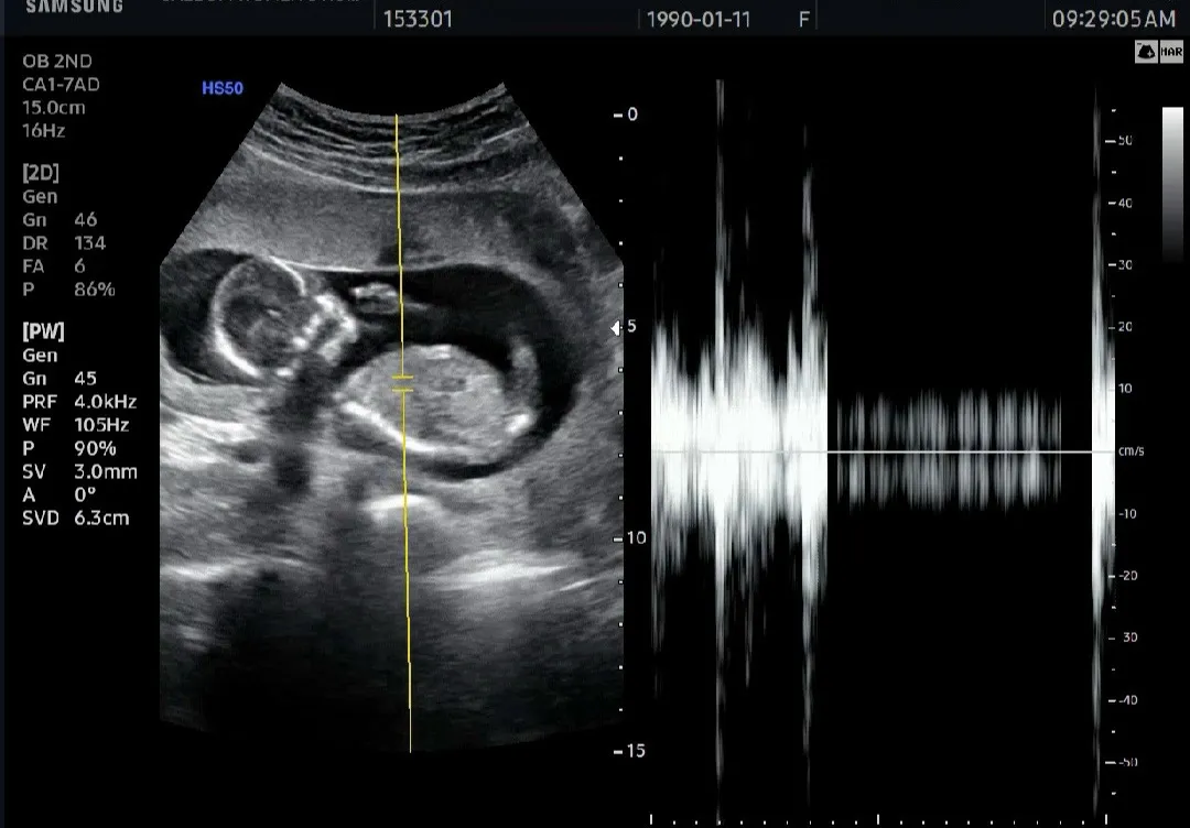 아쉽네요 ㅜ 성별 각도 보시는분?~