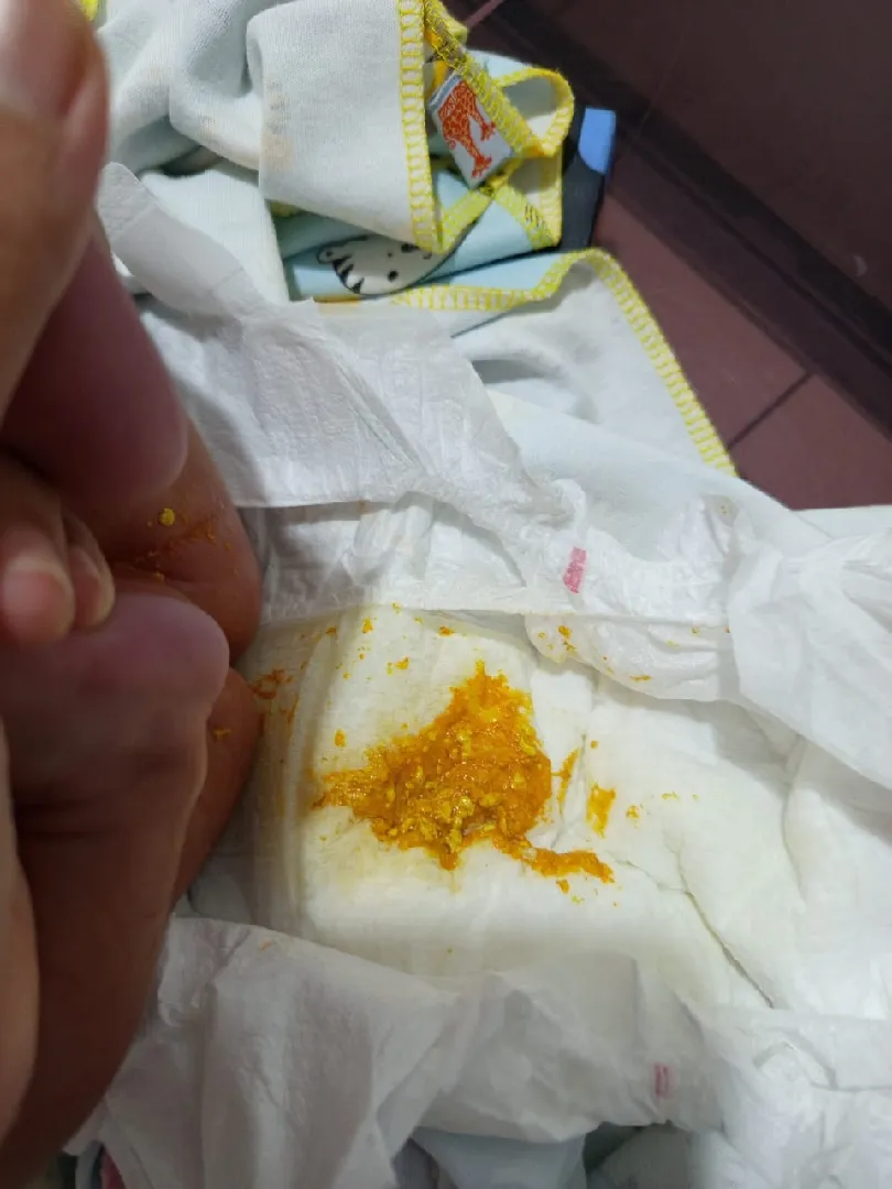 Perut kembung dan keras
