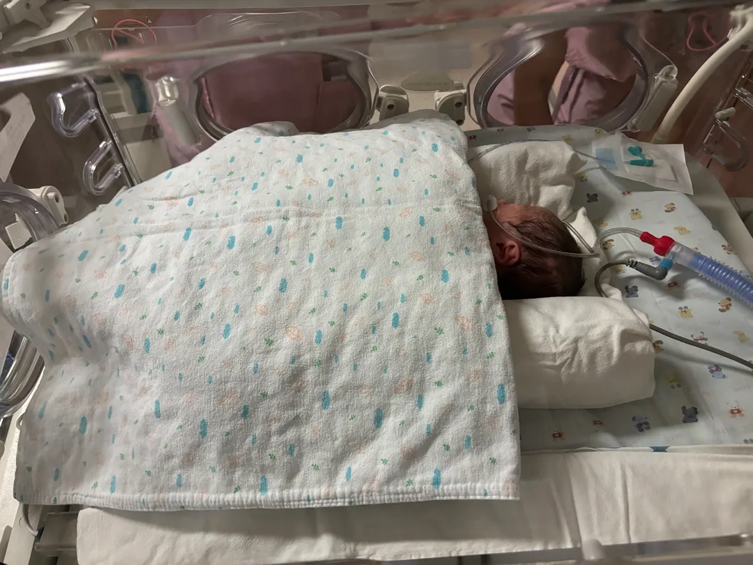 34주 출산 ㅠㅠ 조산 이른둥이 출산(1.7kg)