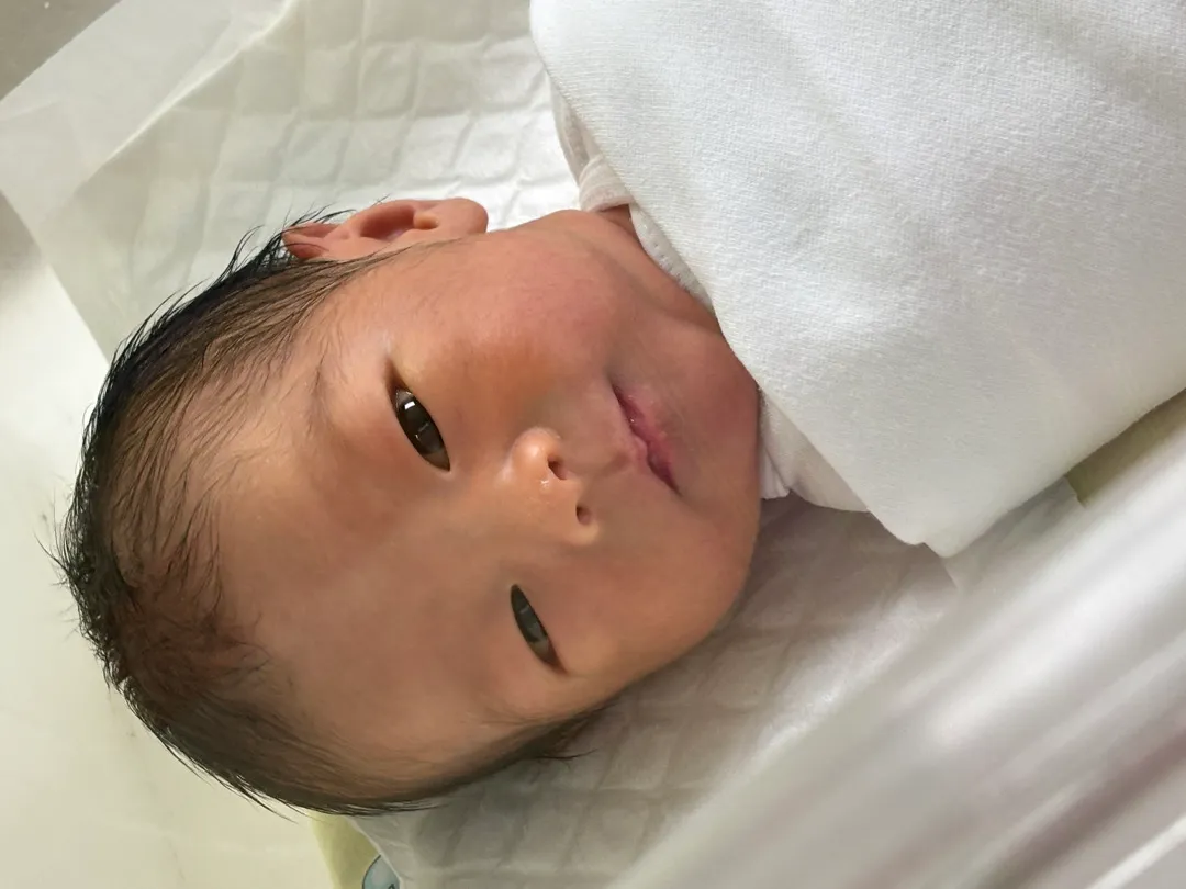 제왕절개했어용!!