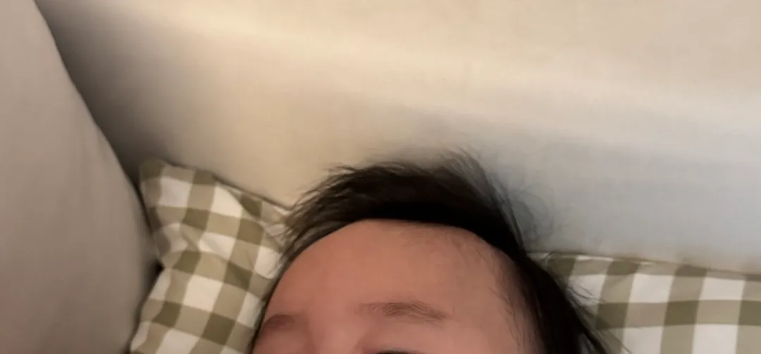 아기 이마 가운데가 볼록해요ㅠ
