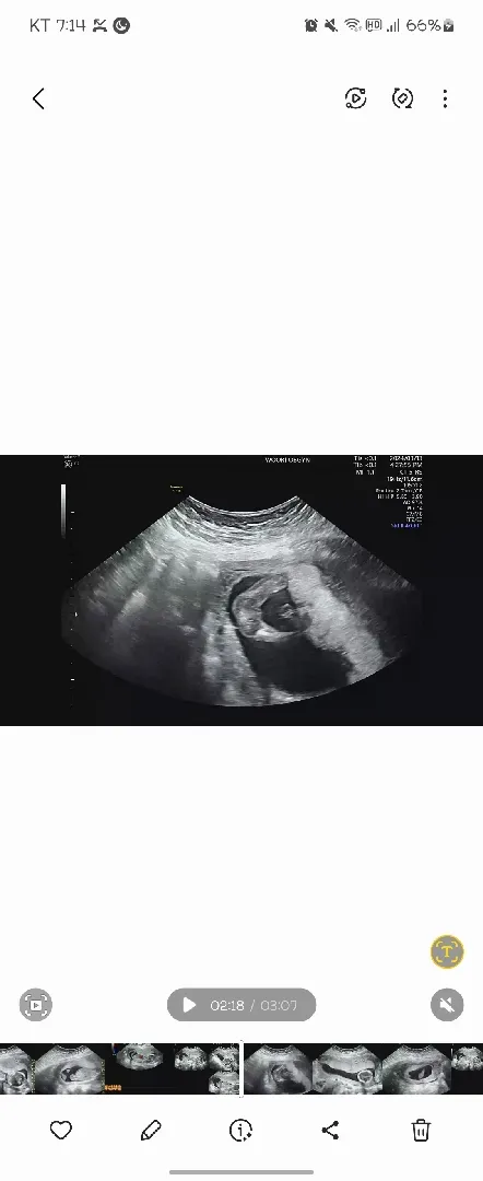 16주입니당 , 봐주세요ㅠㅠ