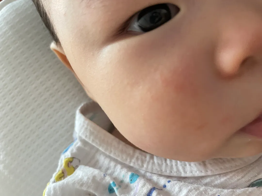 알레르기일까요??